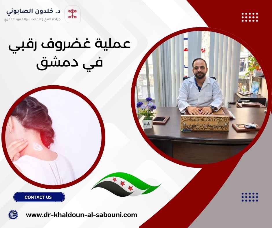 عملية غضروف رقبي في دمشق عملية غضروف رقبي في دمشق