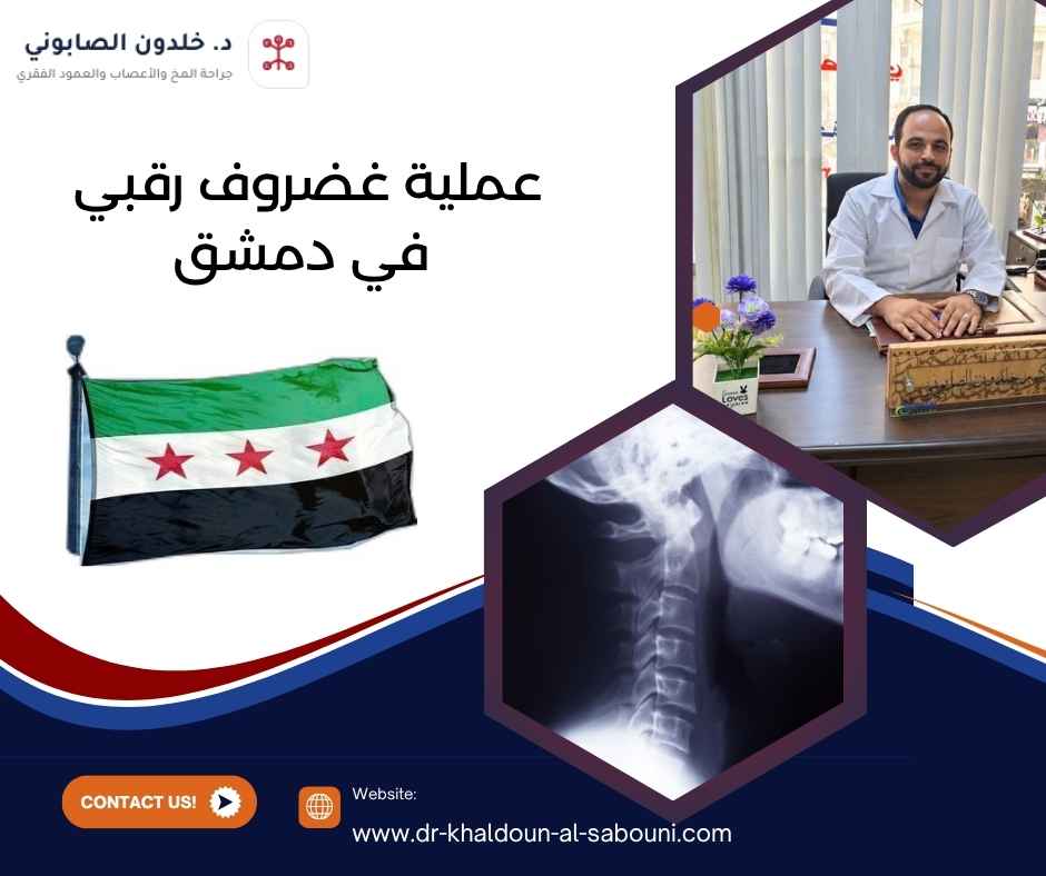 عملية غضروف رقبي في دمشق عملية غضروف رقبي في دمشق