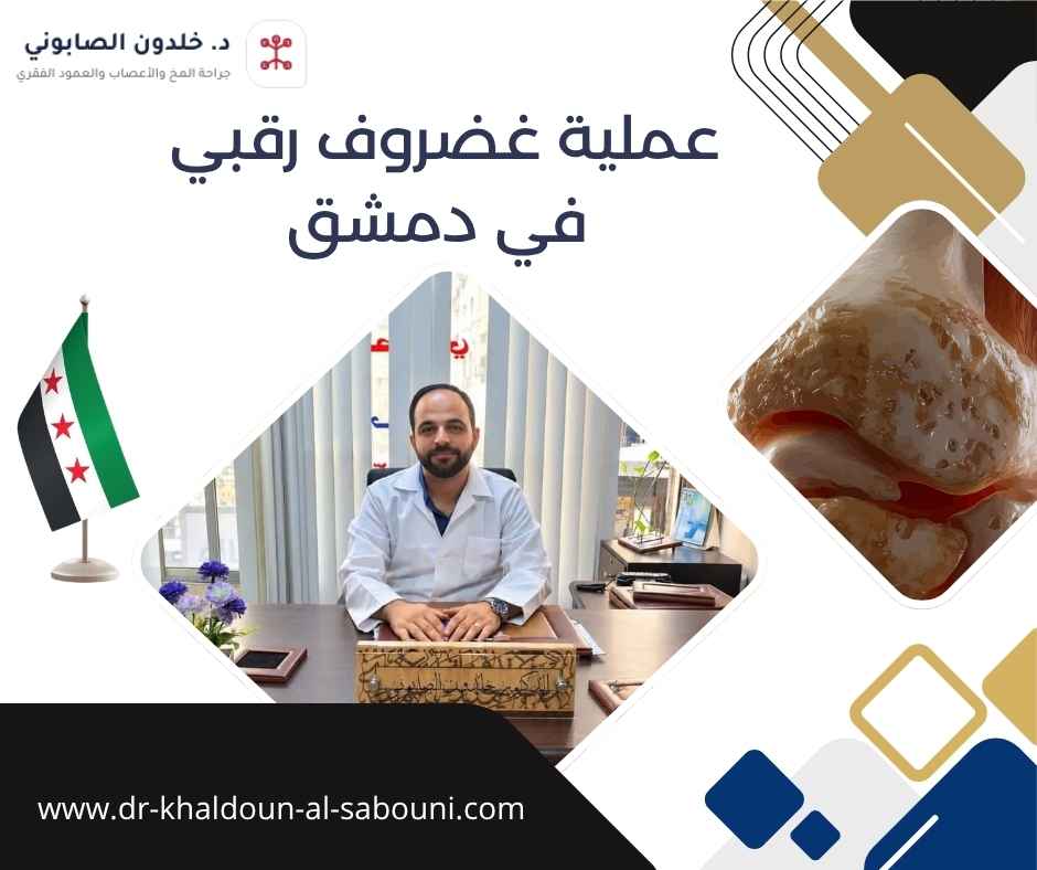 عملية غضروف رقبي في دمشق عملية غضروف رقبي في دمشق