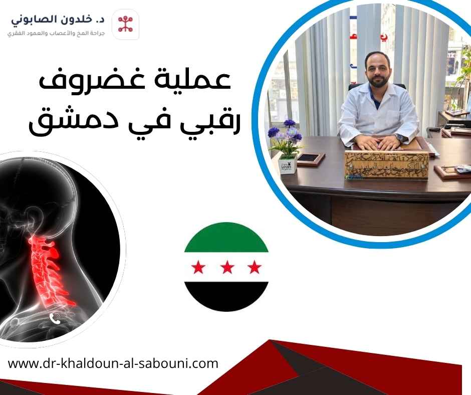 عملية غضروف رقبي في دمشق عملية غضروف رقبي في دمشق