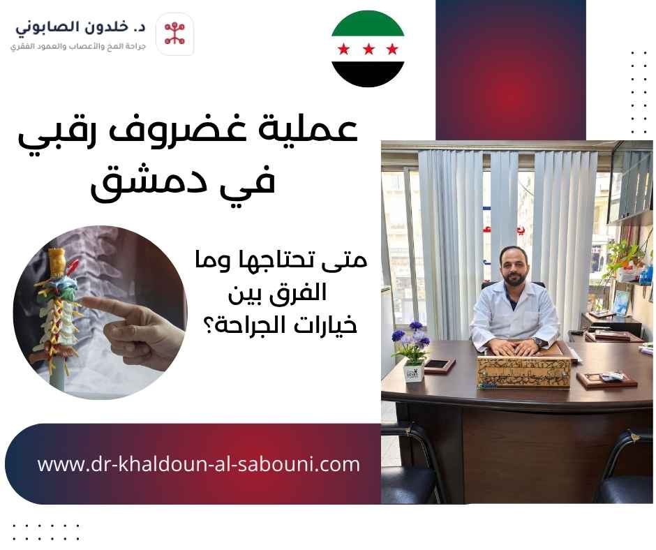 عملية غضروف رقبي في دمشق