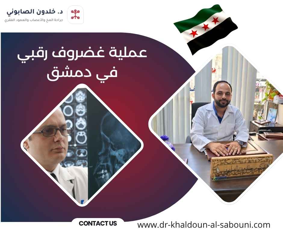 عملية غضروف رقبي في دمشق عملية غضروف رقبي في دمشق