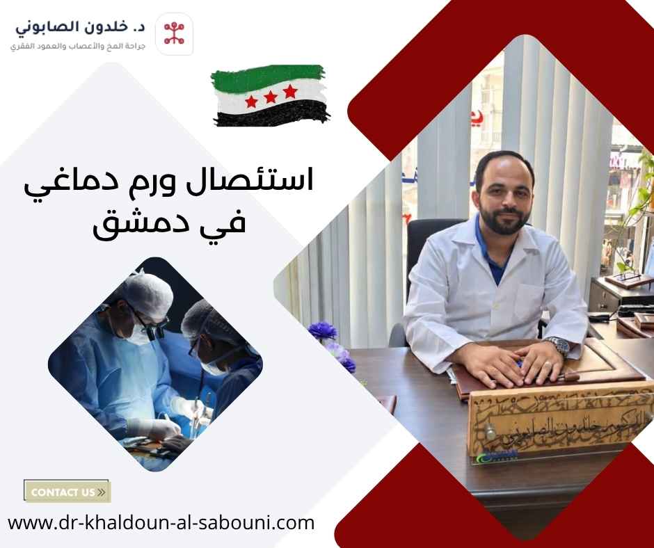 استئصال ورم دماغي في دمشق استئصال ورم دماغي في دمشق
