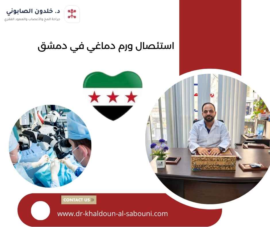 استئصال ورم دماغي في دمشق استئصال ورم دماغي في دمشق