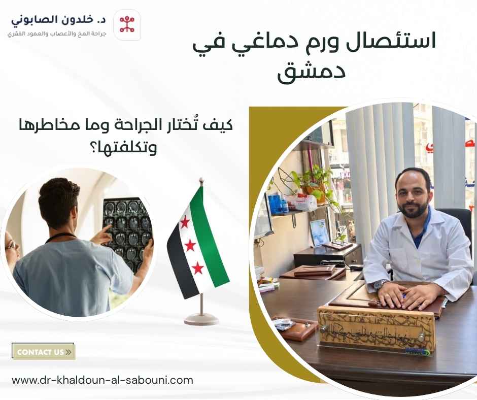 استئصال ورم دماغي في دمشق