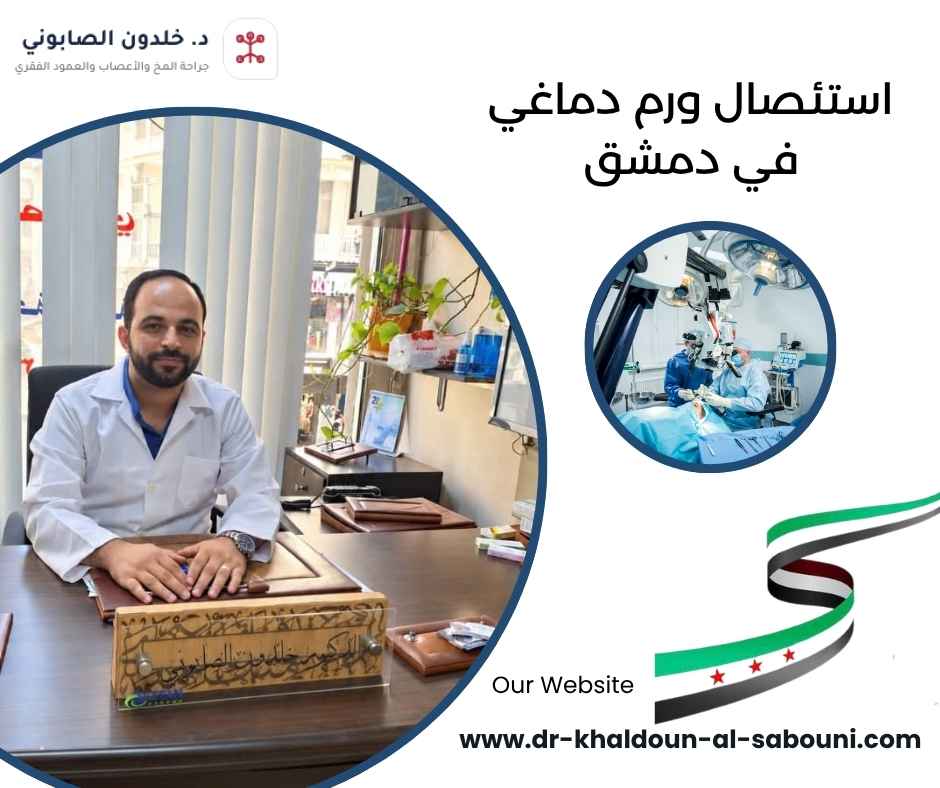 استئصال ورم دماغي في دمشق استئصال ورم دماغي في دمشق