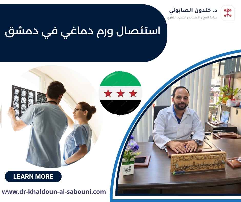 استئصال ورم دماغي في دمشق استئصال ورم دماغي في دمشق