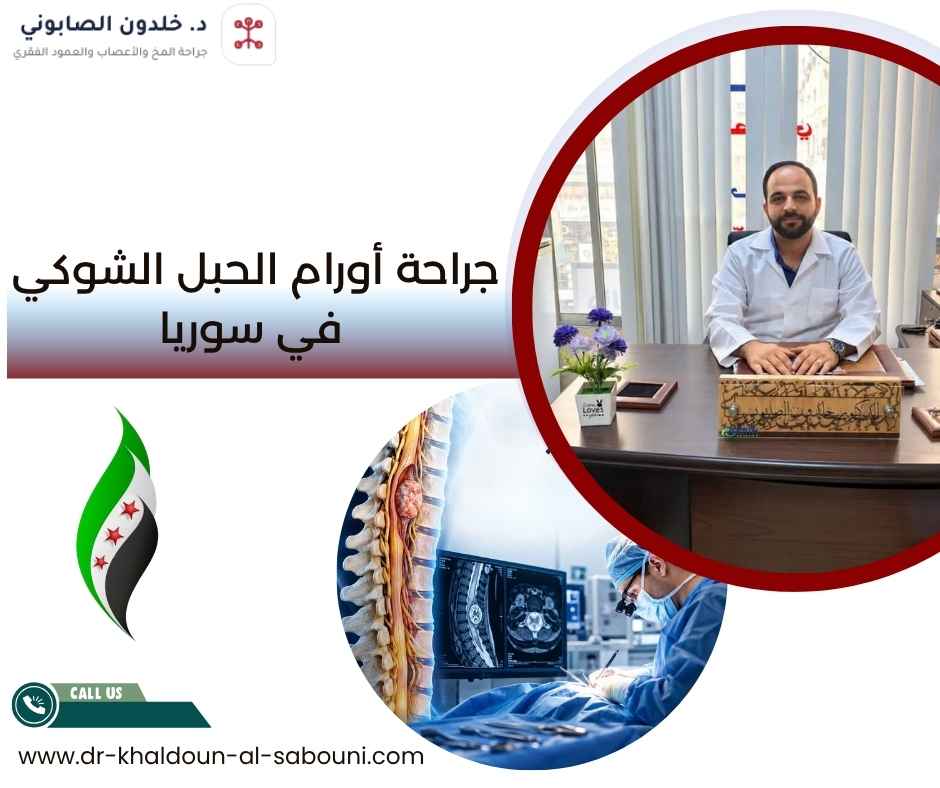 جراحة أورام الحبل الشوكي في سوريا