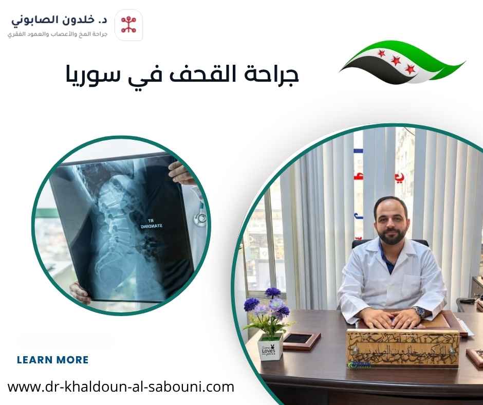 جراحة القحف في سوريا