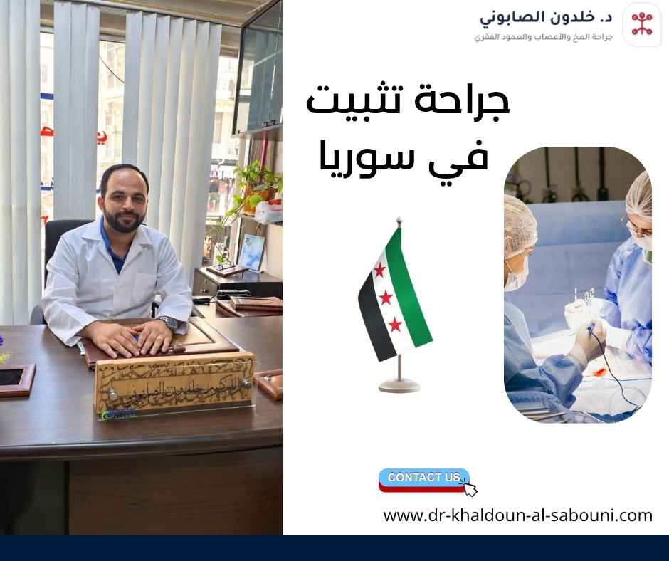 جراحة تثبيت الفقرات في سوريا