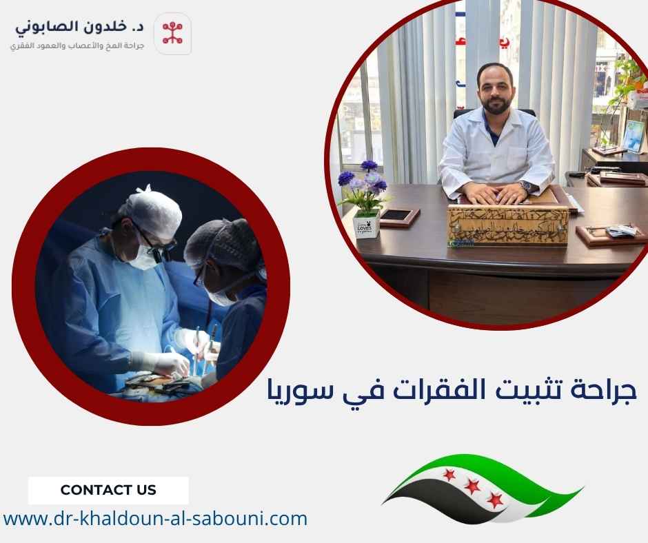 جراحة تثبيت الفقرات في سوريا