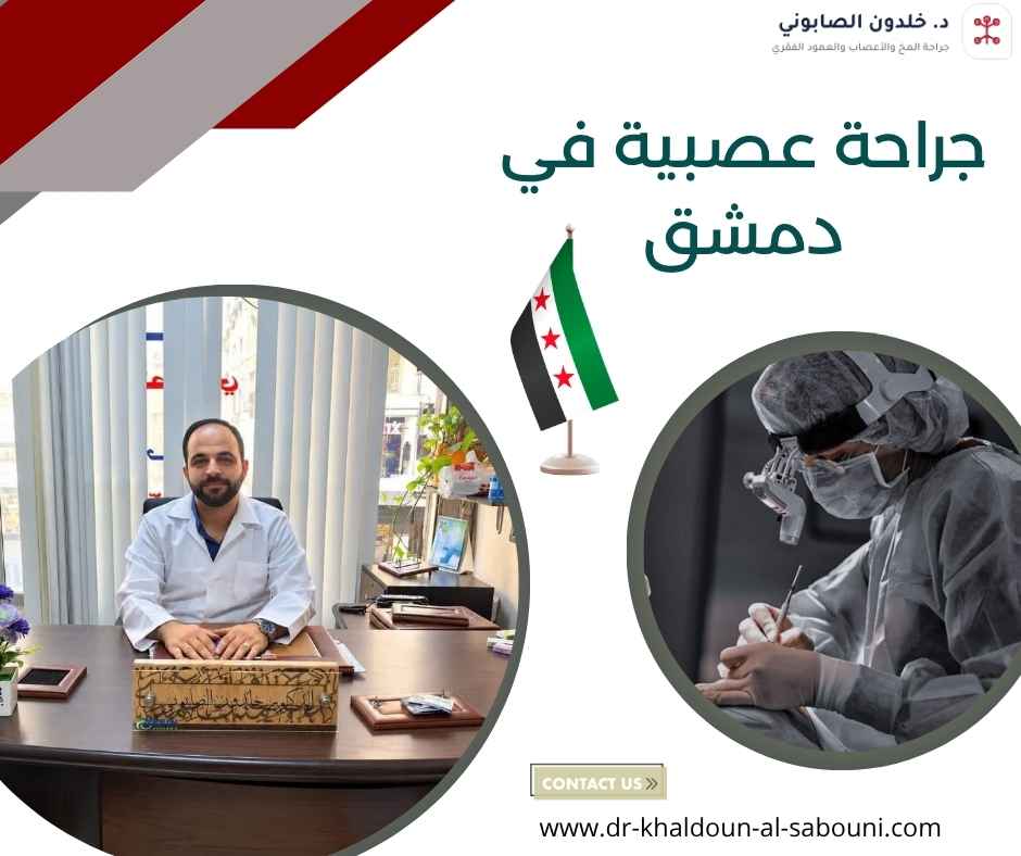 جراحة عصبية في دمشق