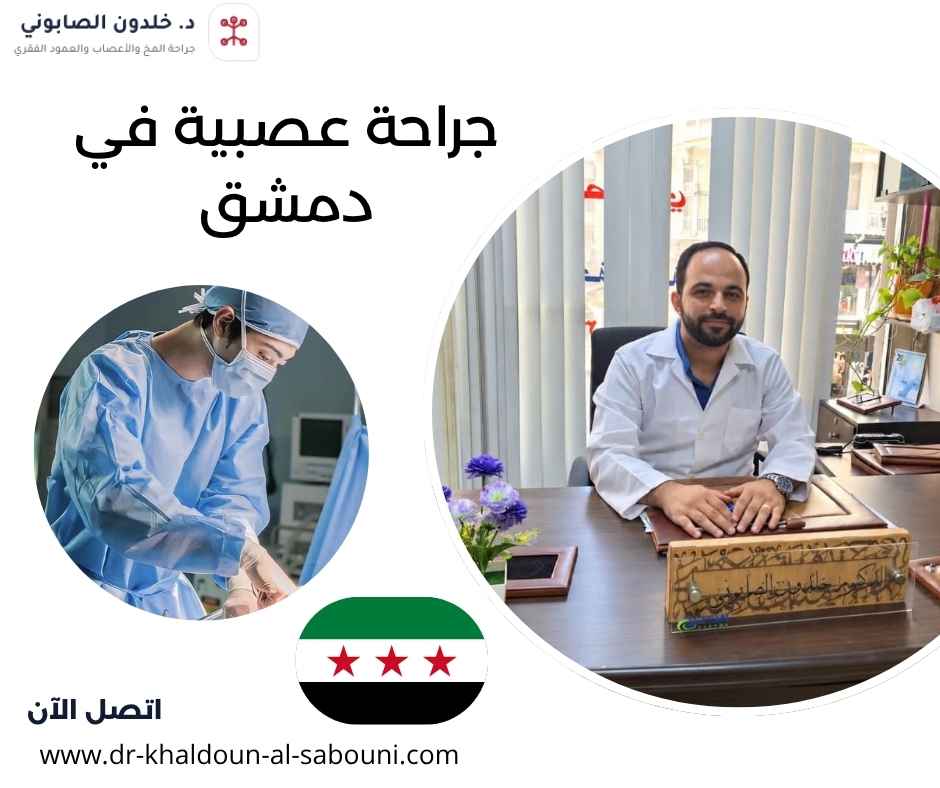 جراحة عصبية في دمشق