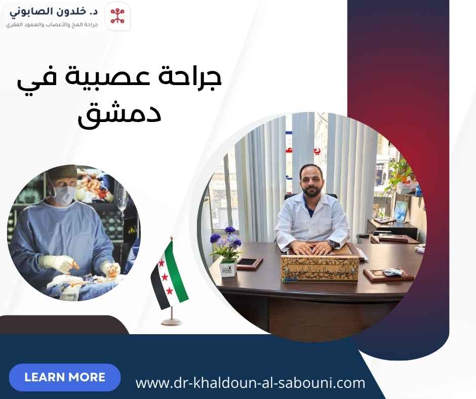 جراحة عصبية في دمشق