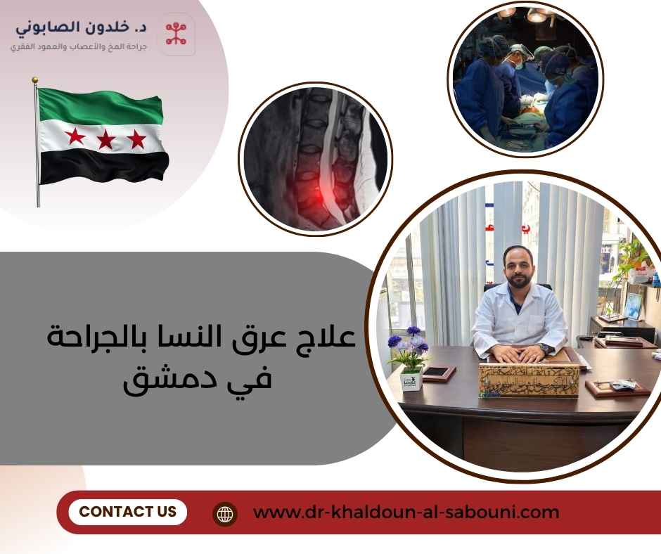 علاج عرق النسا بالجراحة في دمشق